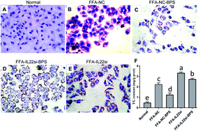 Graphical abstract: Blueberry, combined with probiotics, alleviates non-alcoholic fatty liver disease via IL-22-mediated JAK1/STAT3/BAX signaling