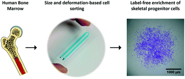 Graphical abstract: Label-free enrichment of primary human skeletal progenitor cells using deterministic lateral displacement