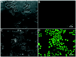 Graphical abstract: Live-cell fluorescence imaging: assessment of thioflavin T uptake in human epidermal carcinoma cells