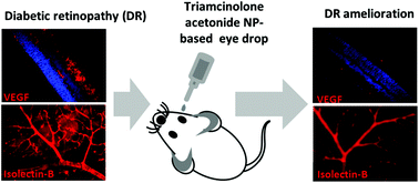 Graphical abstract: A non-invasive nanoparticle mediated delivery of triamcinolone acetonide ameliorates diabetic retinopathy in rats