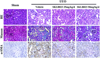 Graphical abstract: SKLB023 hinders renal interstitial fibrosis in obstructive nephropathy by interfering TGF-β1/Smad3 signaling