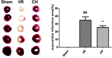 Graphical abstract: Retracted Article: Chrysin attenuates myocardial ischemia–reperfusion injury by inhibiting myocardial inflammation