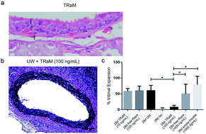 Graphical abstract: Organ preservation with targeted rapamycin nanoparticles: a pre-treatment strategy preventing chronic rejection in vivo