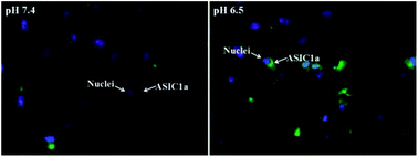 Graphical abstract: Retracted Article: ASIC1a involves acidic microenvironment-induced activation and autophagy of pancreatic stellate cells