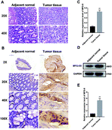 Graphical abstract: Coptisine suppresses tumor growth and progression by down-regulating MFG-E8 in colorectal cancer