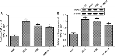 Graphical abstract: Retracted Article: FOXC1 silencing promotes A549 cell apoptosis through inhibiting the PI3K/AKT/hedgehog/Gli2 signaling pathway