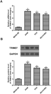 Graphical abstract: Silencing TRIM37 inhibits the proliferation and migration of non-small cell lung cancer cells