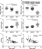 Graphical abstract: Retracted Article: MiR-182-5p and miR-96-5p increased hepatocellular carcinoma cell mobility, proliferation and cisplatin resistance partially by targeting RND3