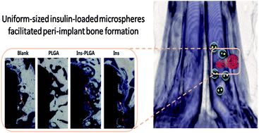 Graphical abstract: The effect of a single injection of uniform-sized insulin-loaded PLGA microspheres on peri-implant bone formation