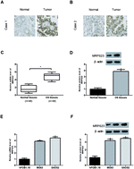 Graphical abstract: Retracted Article: Down-regulation of MRPS23 inhibits LPS-induced proliferation and invasion via regulation of the NF-κB signaling pathway in osteosarcoma cells