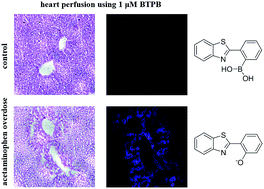 Graphical abstract: Observation of the generation of peroxynitrite in mouse liver after acetaminophen overdose with a boronate-based ratiometric fluorescence probe