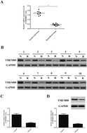 Graphical abstract: Retracted Article: TMEM88 inhibits fibrosis in renal proximal tubular epithelial cells by suppressing the transforming growth factor-β1/Smad signaling pathway