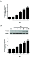 Graphical abstract: Knockdown of FOXO6 inhibits cell proliferation and ECM accumulation in glomerular mesangial cells cultured under high glucose condition