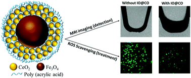 Graphical abstract: Novel iron oxide–cerium oxide core–shell nanoparticles as a potential theranostic material for ROS related inflammatory diseases