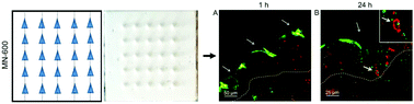Graphical abstract: Bioceramic microneedle arrays are able to deliver OVA to dendritic cells in human skin