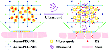 Graphical abstract: Microcapsule-embedded hydrogel patches for ultrasound responsive and enhanced transdermal delivery of diclofenac sodium