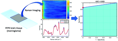 Graphical abstract: Determination of meningioma brain tumour grades using Raman microspectroscopy imaging