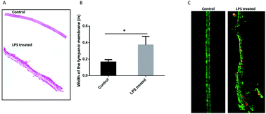 Graphical abstract: Identification of early inflammatory changes in the tympanic membrane with Raman spectroscopy