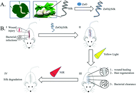 Graphical abstract: Porous ZnO modified silk sutures with dual light defined antibacterial, healing promotion and controlled self-degradation capabilities