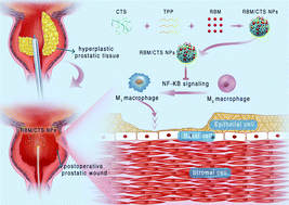 Graphical abstract: Rebamipide-loaded chitosan nanoparticles accelerate prostatic wound healing by inhibiting M1 macrophage-mediated inflammation via the NF-κB signaling pathway