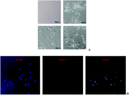 Graphical abstract: EPA-enriched ethanolamine plasmalogen and EPA-enriched phosphatidylethanolamine enhance BDNF/TrkB/CREB signaling and inhibit neuronal apoptosis in vitro and in vivo