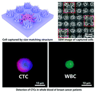 Graphical abstract: Size-matching hierarchical micropillar arrays for detecting circulating tumor cells in breast cancer patients’ whole blood