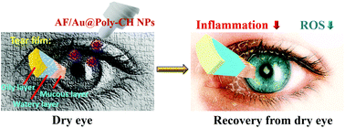 Graphical abstract: Synergistically dual-functional nano eye-drops for simultaneous anti-inflammatory and anti-oxidative treatment of dry eye disease