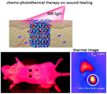 Graphical abstract: Mussel-inspired cryogels for promoting wound regeneration through photobiostimulation, modulating inflammatory responses and suppressing bacterial invasion