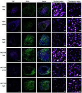 Graphical abstract: Mechanical force regulation of YAP by F-actin and GPCR revealed by super-resolution imaging