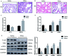 Graphical abstract: miR-let-7d attenuates EMT by targeting HMGA2 in silica-induced pulmonary fibrosis