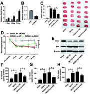 Graphical abstract: Down-regulation of lncRNA GAS5 attenuates neuronal cell injury through regulating miR-9/FOXO3 axis in cerebral ischemic stroke