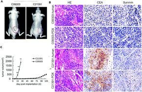 Graphical abstract: Patient-derived bladder cancer xenograft models reveal VEGF and CDK4 enhancing tumor metastasis behavior