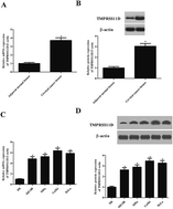 Graphical abstract: Retracted Article: Knockdown of TMPRSS11D inhibits the proliferation, migration and invasion of cervical cancer cells