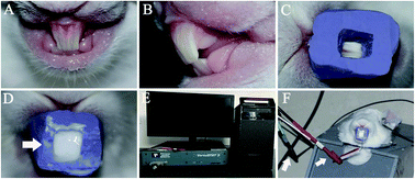 Graphical abstract: Repair of dentine-related lesions without a drill or injection