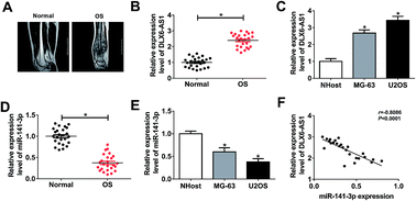 Graphical abstract: Long non-coding RNA DLX6-AS1/miR-141-3p axis regulates osteosarcoma proliferation, migration and invasion through regulating Rab10