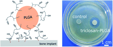 Graphical abstract: Immobilization of poly(lactide-co-glycolide) microspheres on bone implant materials for antibiotic release and the binding mechanisms