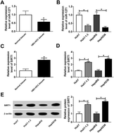 Graphical abstract: Retracted Article: MicroRNA-1271 modulates hepatitis B virus replication, cell proliferation and apoptosis in hepatitis B virus-related hepatocellular carcinoma by targeting SIRT1