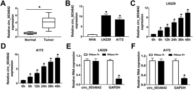 Graphical abstract: Retracted Article: Overexpression of circ_0034642 contributes to hypoxia-induced glycolysis, cell proliferation, migration and invasion in gliomas by facilitating TAGLN2 expression via sponging miR-625-5p