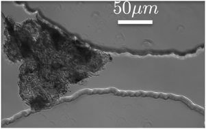 Graphical abstract: Clogging of microfluidic constrictions by monoclonal antibody aggregates: role of aggregate shape and deformability