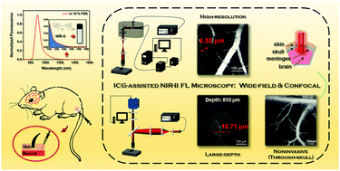 Graphical abstract: Deciphering of cerebrovasculatures via ICG-assisted NIR-II fluorescence microscopy