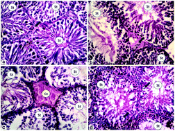 Graphical abstract: Protective effects of zinc oxide nanoparticles against doxorubicin induced testicular toxicity and DNA damage in male rats