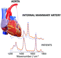Graphical abstract: A new approach to study human perivascular adipose tissue of the internal mammary artery by fiber-optic Raman spectroscopy supported by spectral modelling