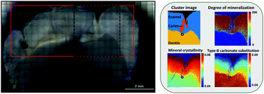 Graphical abstract: Mineralization of dental tissues and caries lesions detailed with Raman microspectroscopic imaging