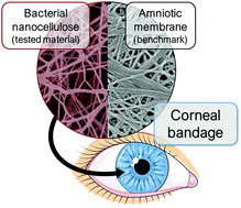Graphical abstract: Bacterial nanocellulose as a corneal bandage material: a comparison with amniotic membrane