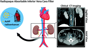 Graphical abstract: In vivo performance of gold nanoparticle-loaded absorbable inferior vena cava filters in a swine model