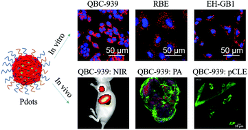 Graphical abstract: NIR/photoacoustic imaging of multitype gallbladder cancer using carboxyl/amino functionalized polymer dots