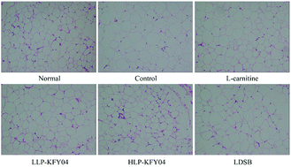 Graphical abstract: Lactobacillus plantarum KFY04 prevents obesity in mice through the PPAR pathway and alleviates oxidative damage and inflammation