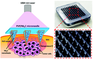 Graphical abstract: A two-dimensional MXene potentiates a therapeutic microneedle patch for photonic implantable medicine in the second NIR biowindow