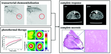 Graphical abstract: A versatile UCST-type composite microsphere for image-guided chemoembolization and photothermal therapy against liver cancer