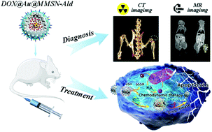 Graphical abstract: Manganese-doped gold core mesoporous silica particles as a nanoplatform for dual-modality imaging and chemo-chemodynamic combination osteosarcoma therapy